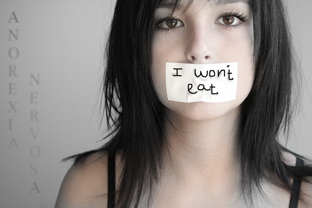 Anorexia – Do I have it?